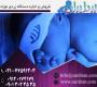 فروش دستگاه  زردی نوزاد و درمان خانگی زردی نوزاد