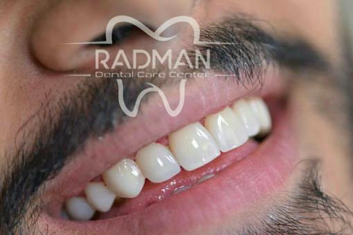 بهترین دندانپزشکی در کرج