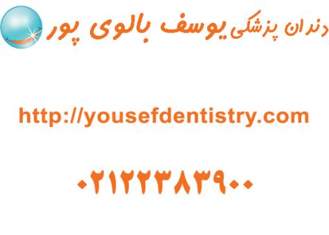 ایمپلنت و لامینت